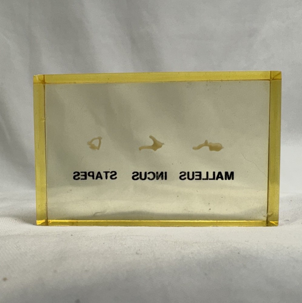 Vintage Embedded Specimen Human Ossicles Ear Bones Osteology