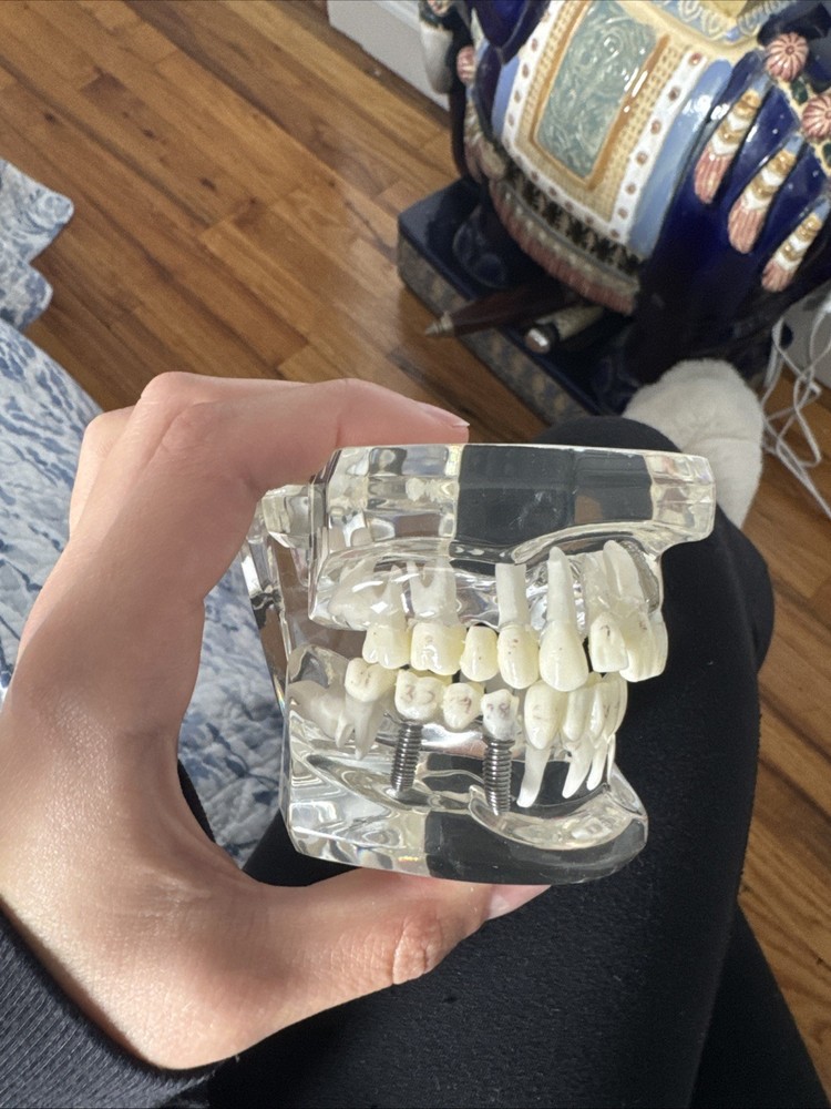 Dental Typodont Model