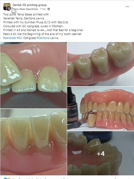 DLP SLA LCD 3d printer temporary teeth resin ..