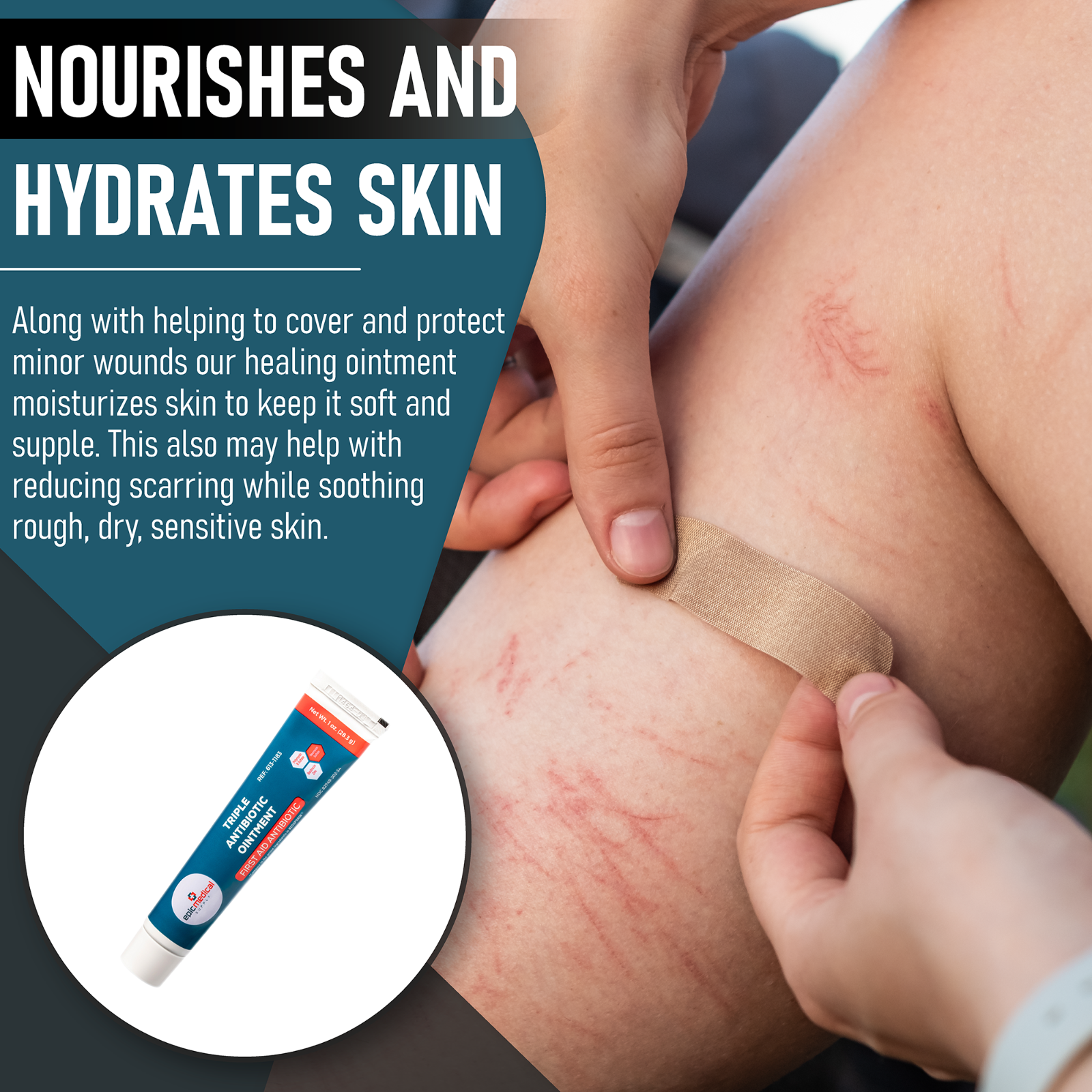 Epic Medical Supply Triple Antibiotic Ointment 1 oz Tube 4 Pack