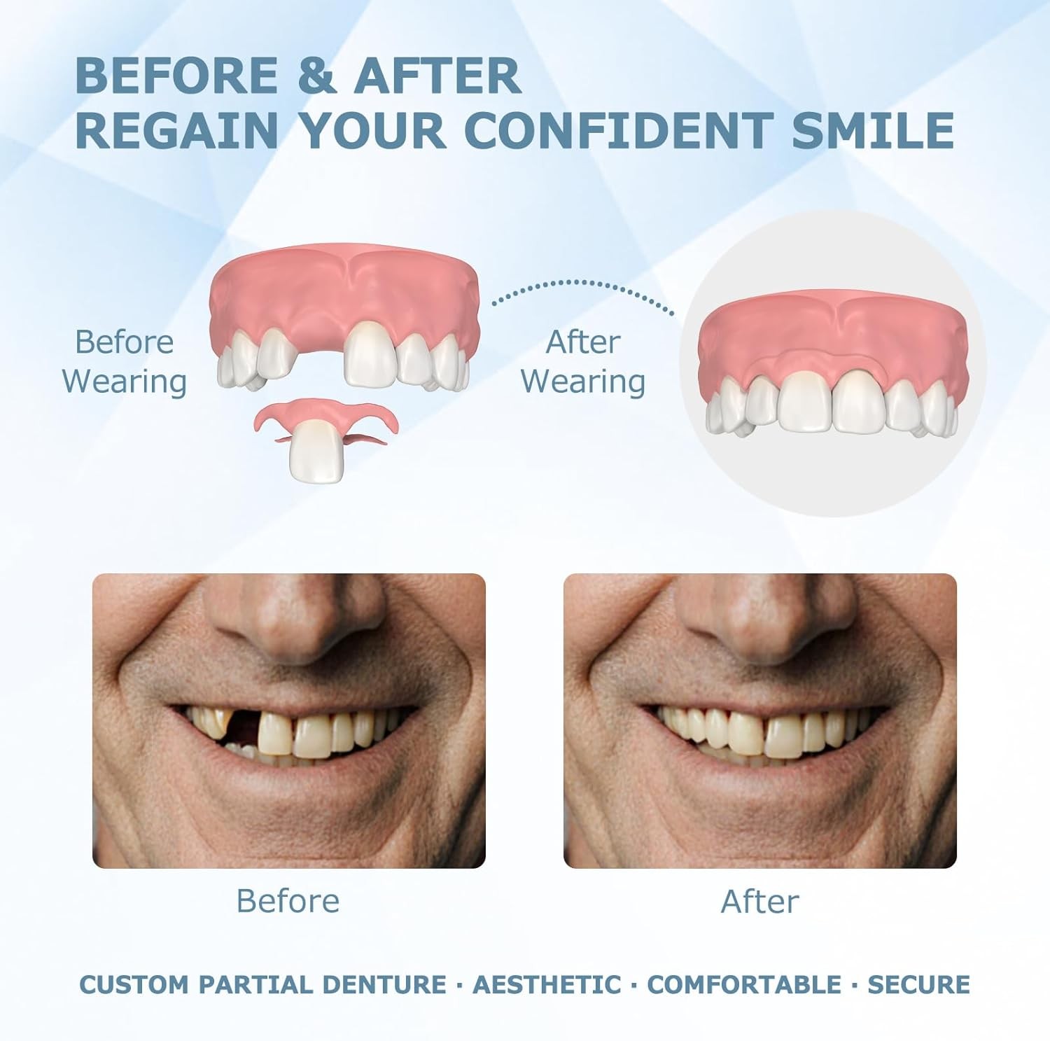 Partial Dentures for Women & Men, Custom Replacement Temporary Flipper Teeth ...