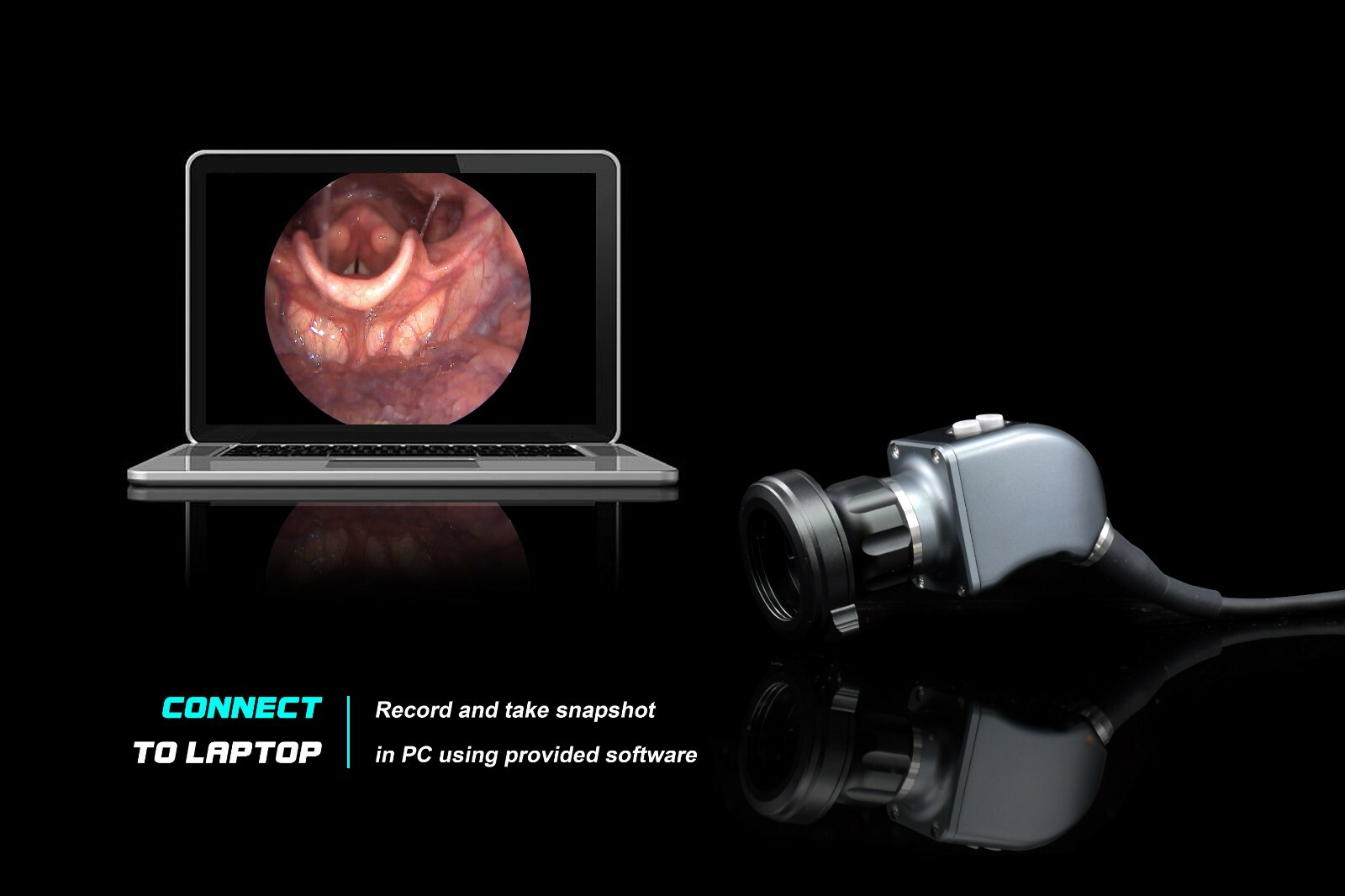 Endoscopy Camera HD 1.2mp for Storz ENT Rigid Endoscope HDMI USB Record in PC