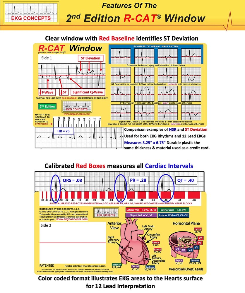 R-CAT EKG Window 2nd Edition