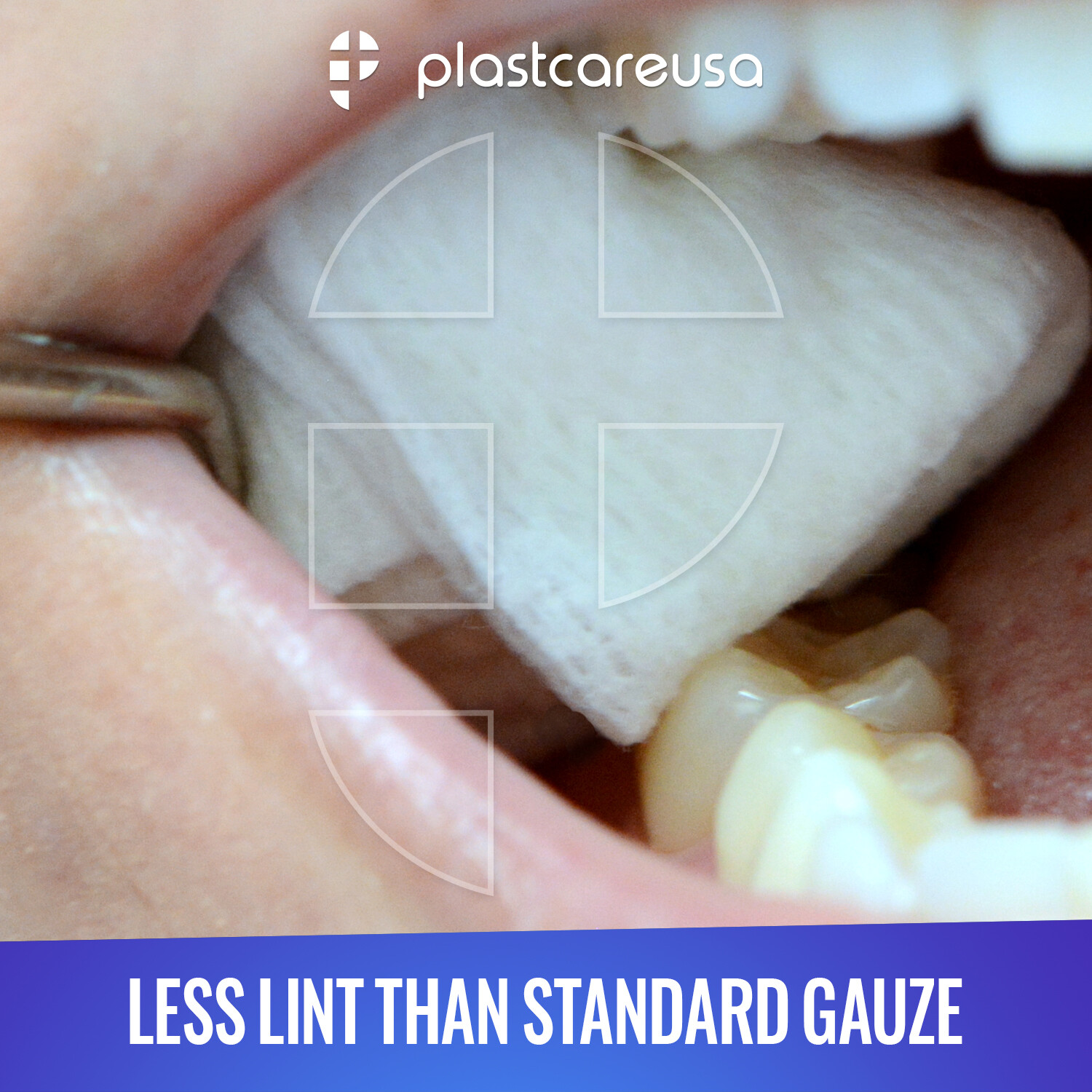 5000 2x2 Non Woven Sponges 4-Ply, Non-Sterile Cotton Dental Gauze (1 Case)