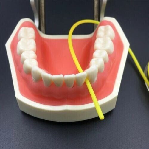 Dental Dam Stabilizing Cord Yellow Medium 7 Ft