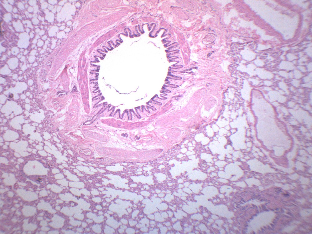 Human Lung Section - Prepared Microscope Slide - 75x25mm - Eisco Labs