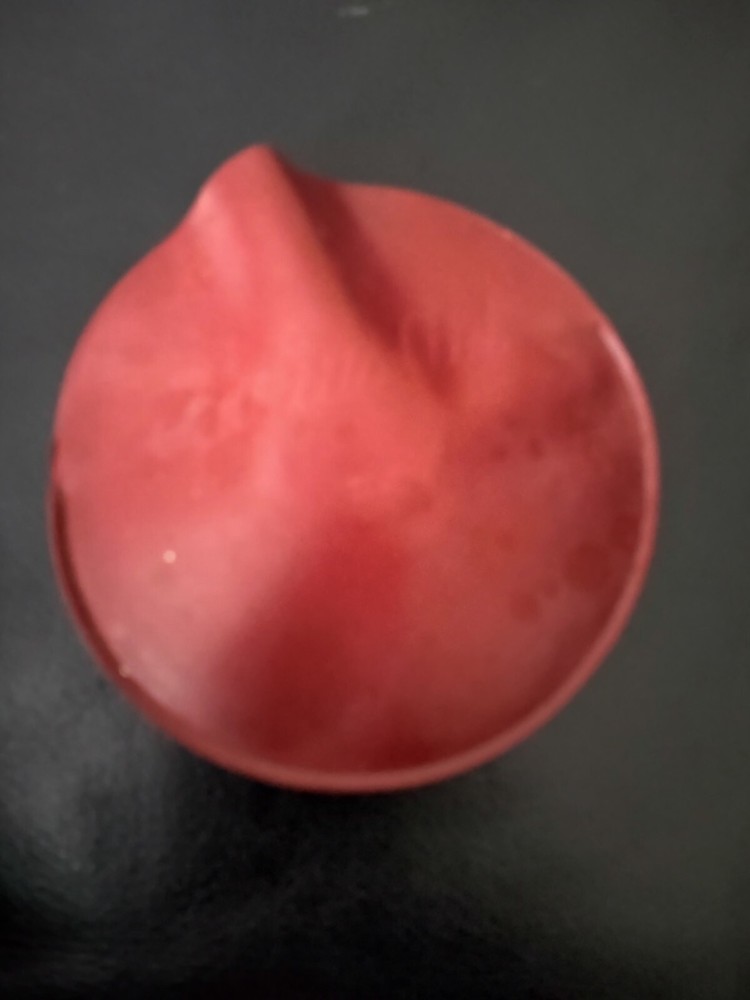 Radius Aid The Arclight Radius Curve