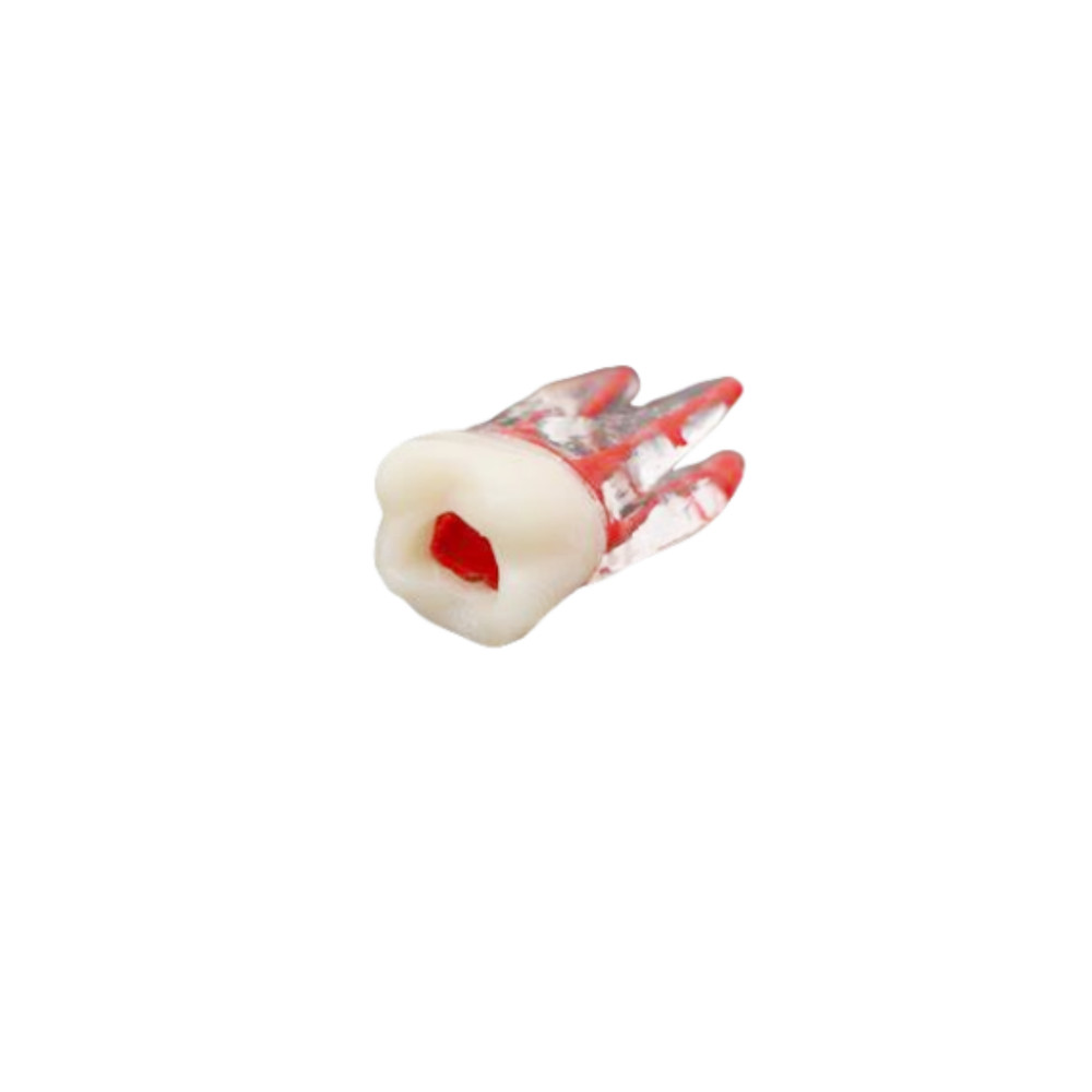 Dental Tooth Endo Root Canal Study Model For RCT Practice Blocks Pulp Cavity