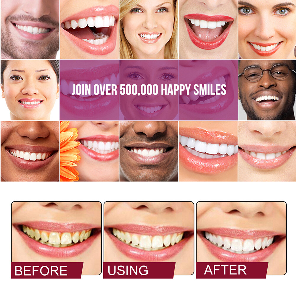 Sp-4 Probiotic Brightening Toothpaste, Deep Cleaning Care Whitening Toothpaste