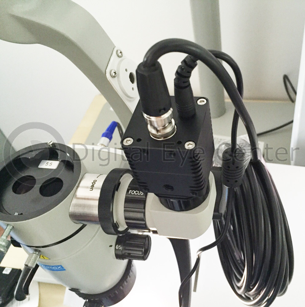 New Microscope Camera Adapter for C Camera for Zeiss Microscope - Posterior Surg