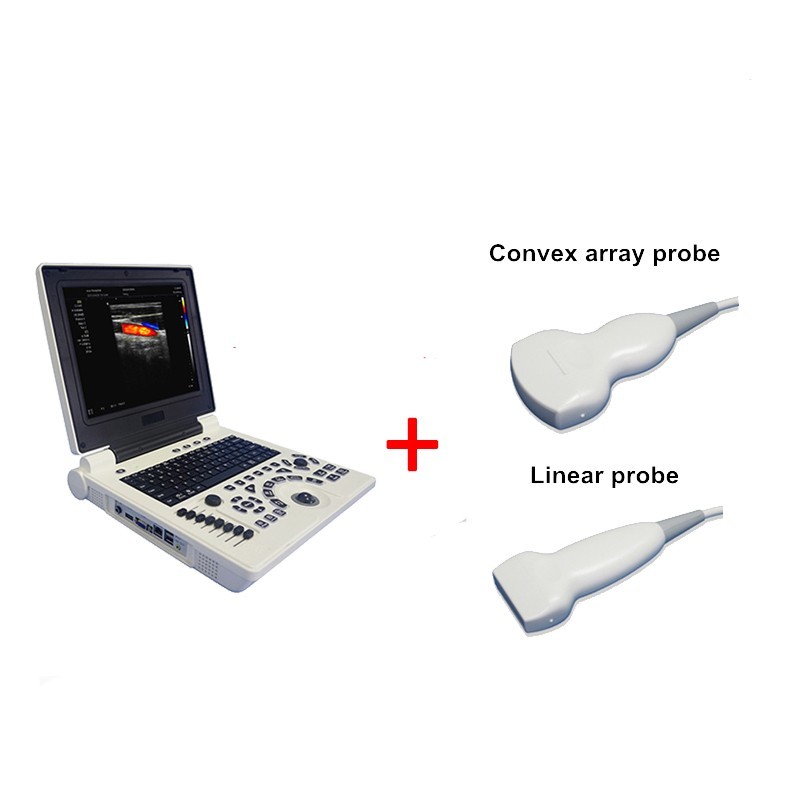 Portable 12 inch laptop ultrasound with convex array probe and linear array prob