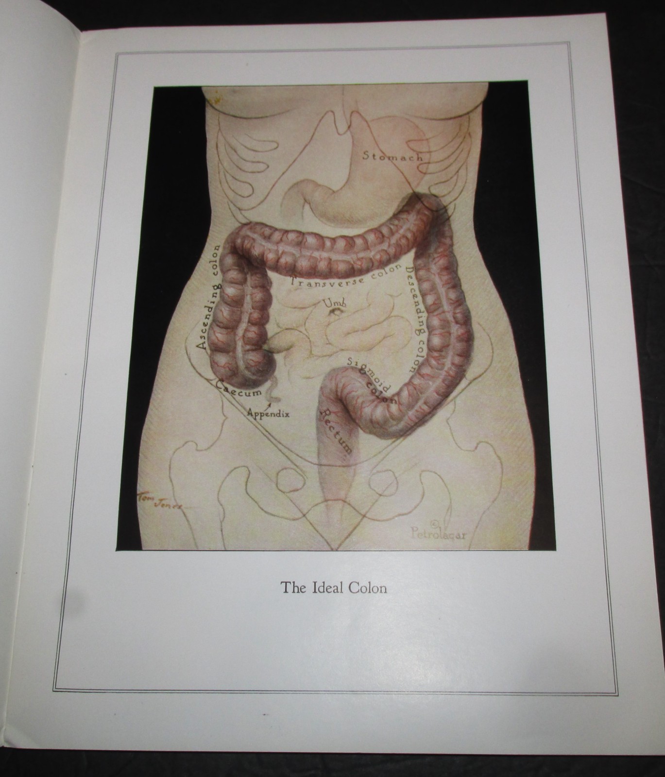 1929 Medical Booklet ILLUSTRATIONS OF THE LARGE BOWEL In Original Envelope