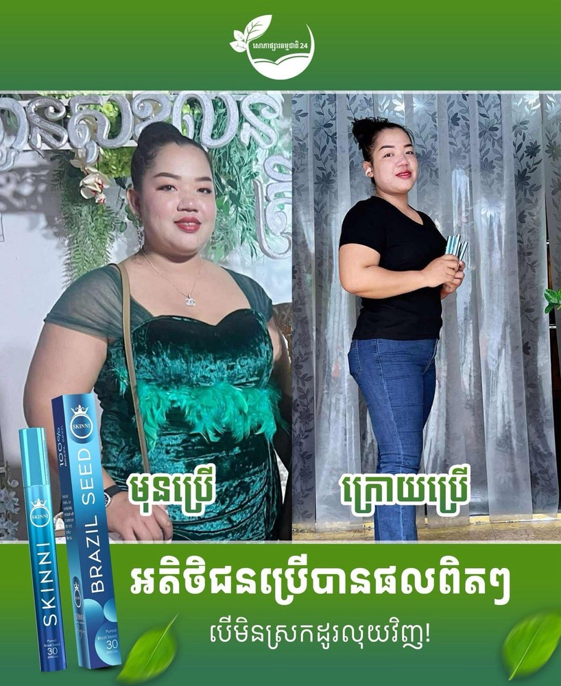 SKINNI Fast Slimគ្រាប់សម្រកធម្មជាតិ ស្គីននី1ប្រអប់( 1ប្រអប់/ 30គ្រាប់ )