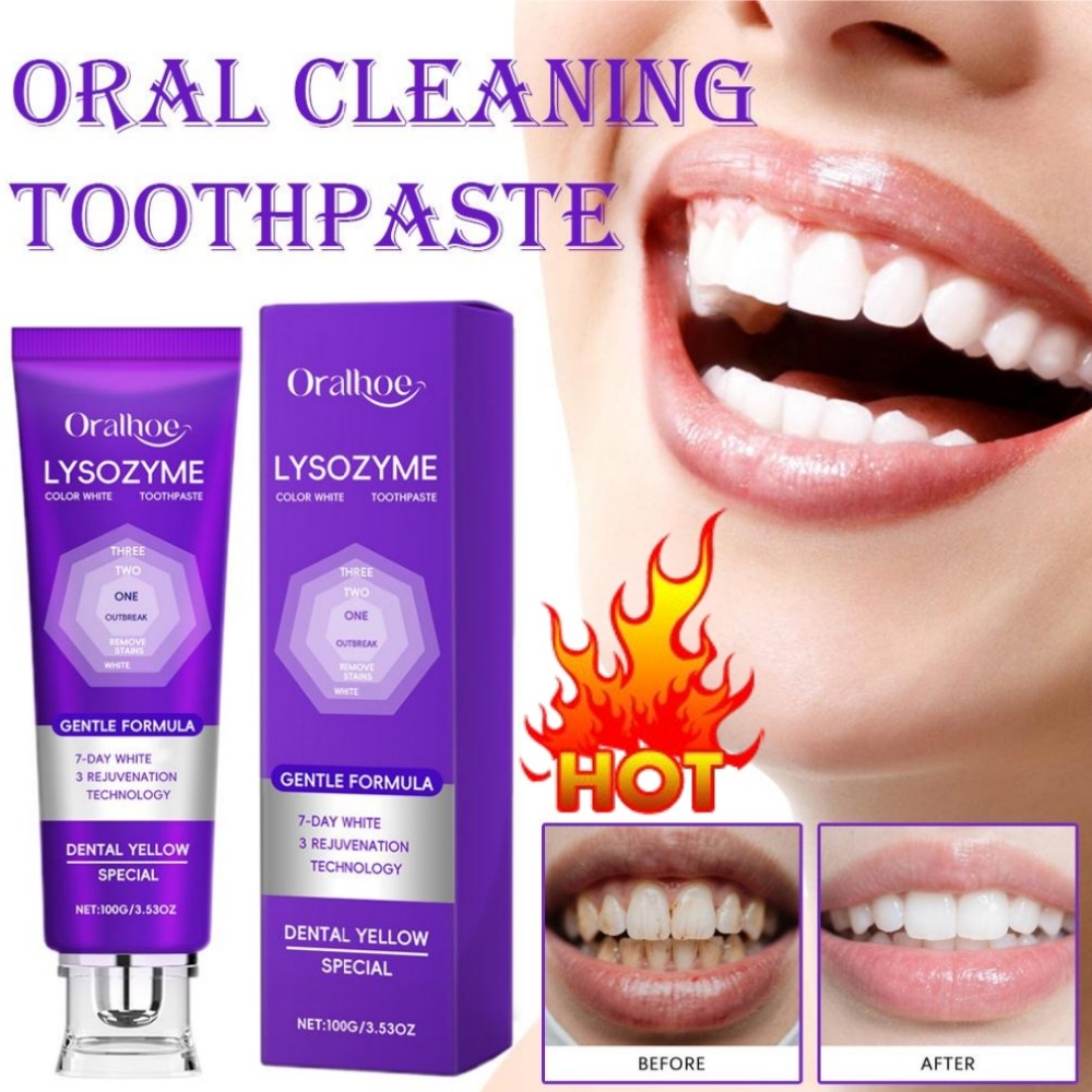 Lysozyme Whitening Toothpaste, 2026 Colour Correcting Purple Toothpaste Hot