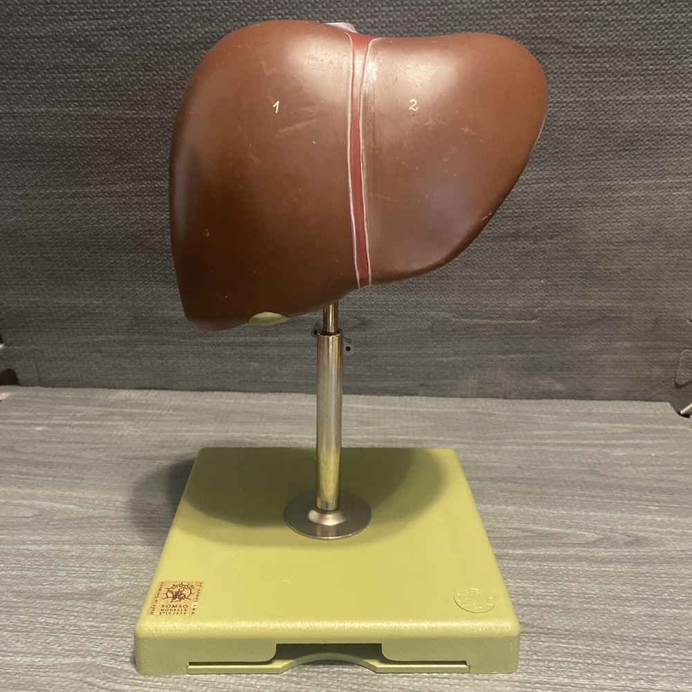 Somso Liver On Adjustable Stand Model - Numbered - Damaged