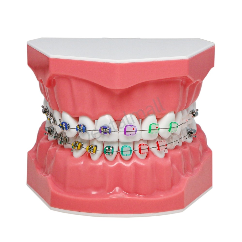 Dental 1:1 Teach Study Typodont Teeth Model With Metal Ceramic Brackets Tubes