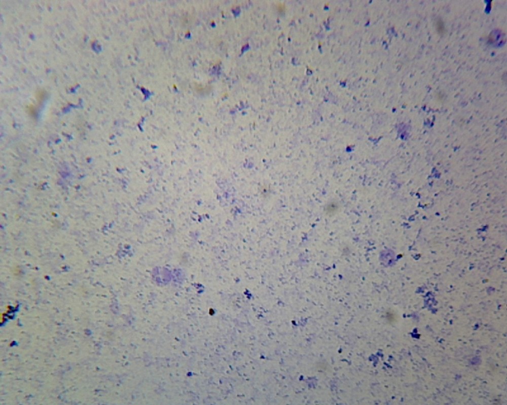 Coccus; Smear; Gram-Positive