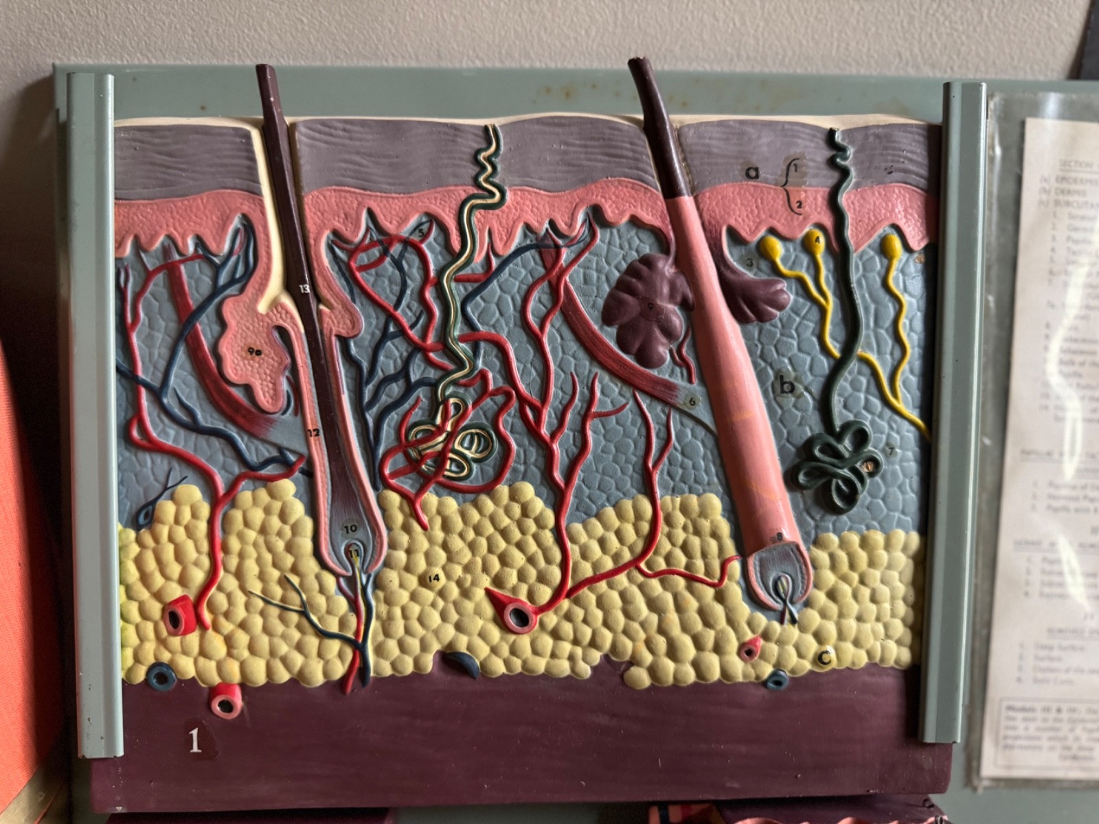 Vintage anatomical model of SKIN Hair follicle & sweat glands