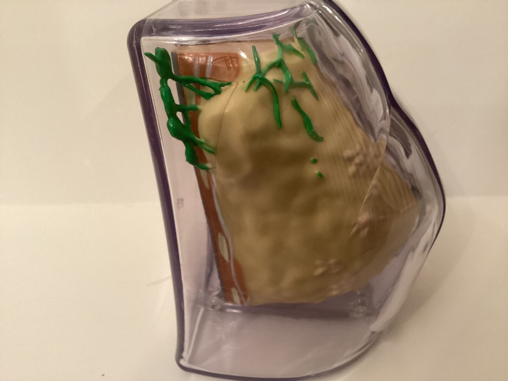 Anatomical Breast Model, 3 Part, 3d Cross-sections, Magnetic Closure, Anomaly