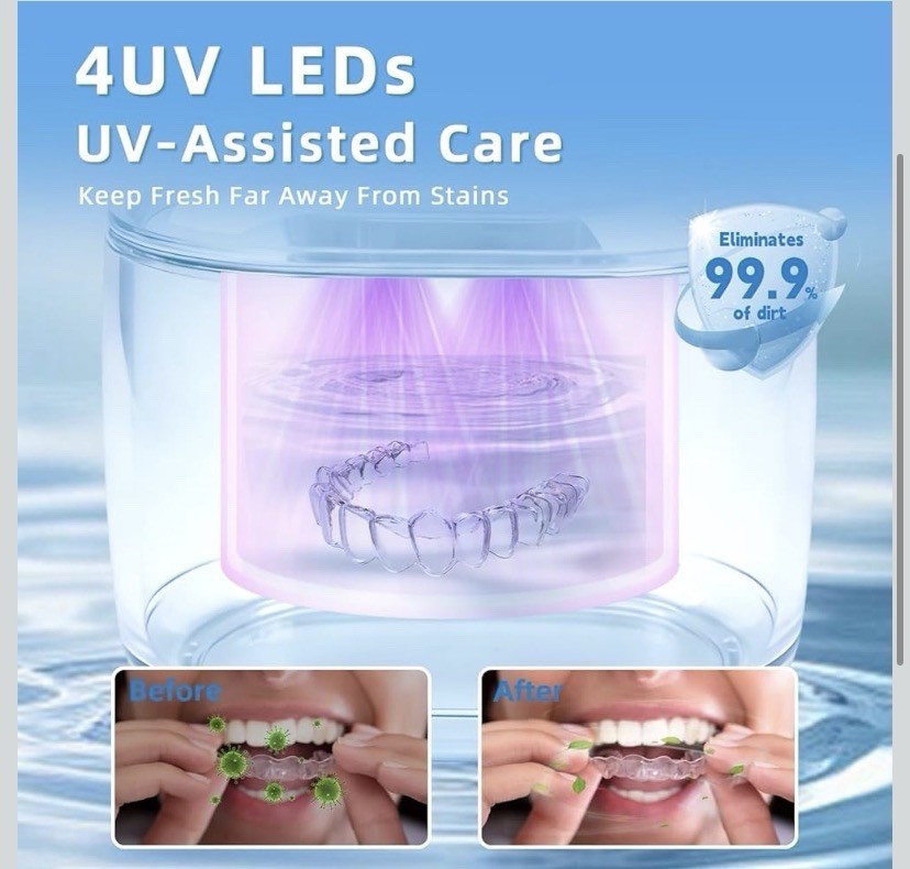 Ultrasonic Retainer Cleaner