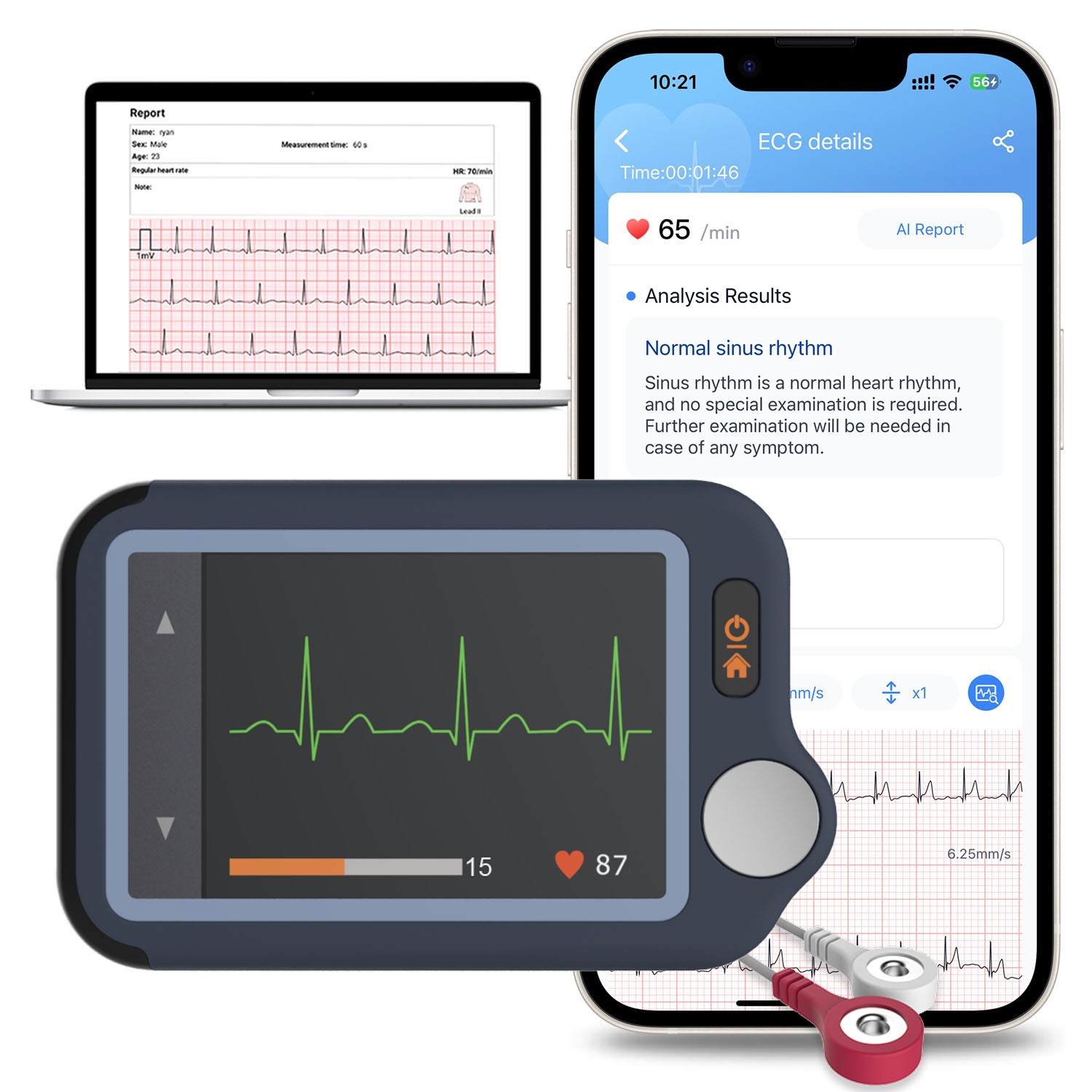 Touch Screen EKG Monitor Heart Monitor with ECG Cable AI-ECG Analysis via App