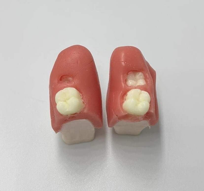 Dental Impacted Tooth Extraction Practice Model Dental Training Display