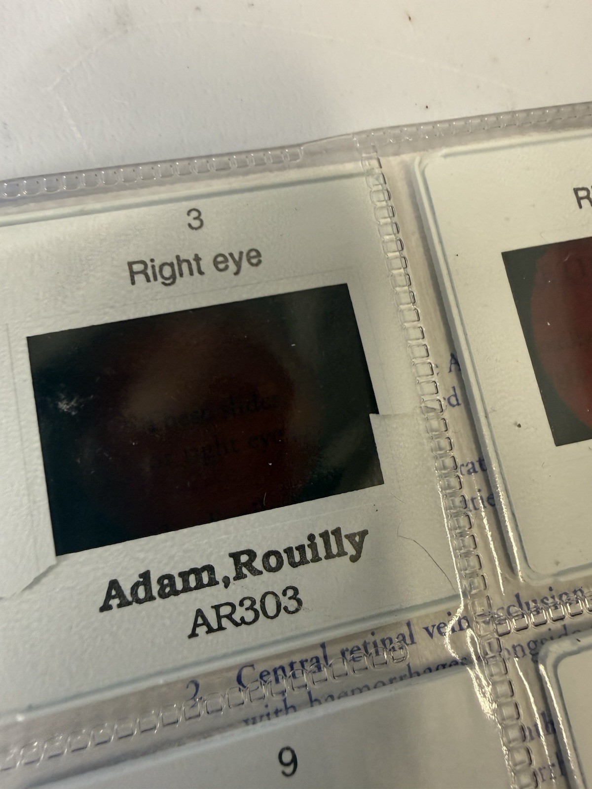 Kyoto Kagaku M82A EYE Examination Simulator Head (2 Steps) -Pls Read Description