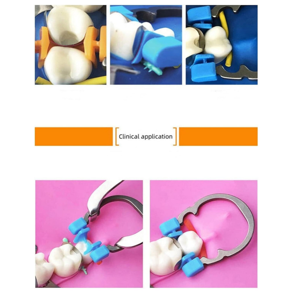 Dental Matrix Bands Ring Titanium Clamp Sectional Contoured Matrices Clamp ﻿