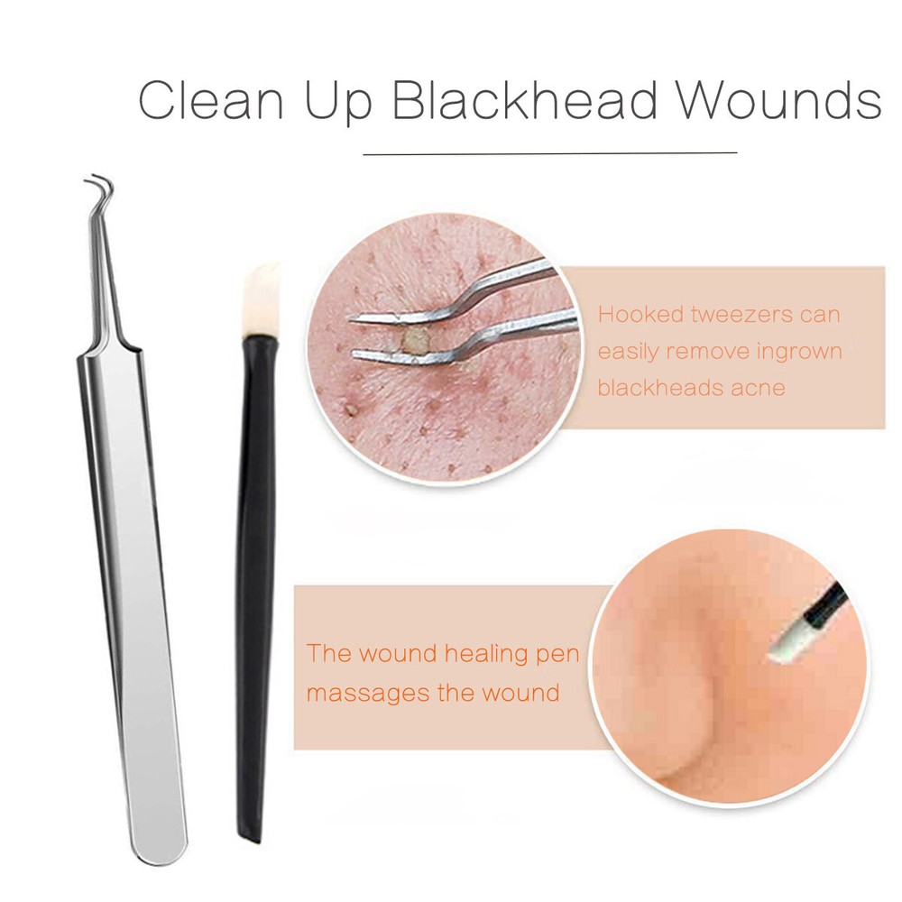 9pcs Pimple Popper Blackhead acne extractor Kit Dr Tool extraction Extractor