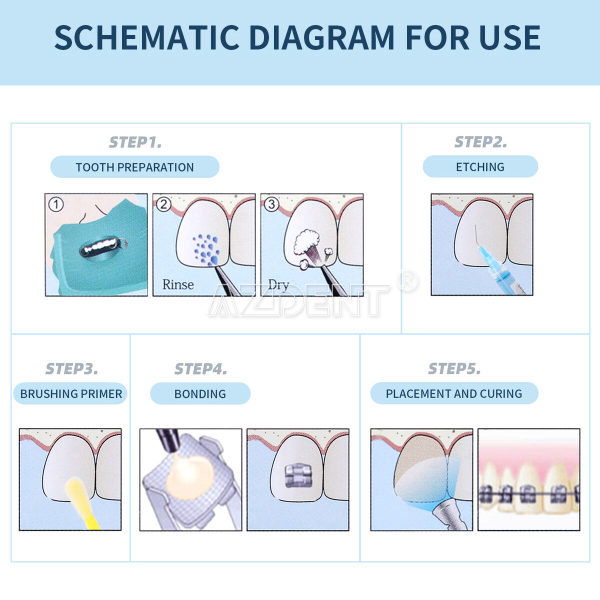 Dental Orthodontic Light Cure Brackets Mini Adhesive Bonding System Kit