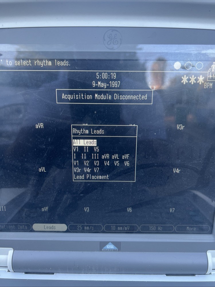 GE Mac 5000 Powers On Sold As Is