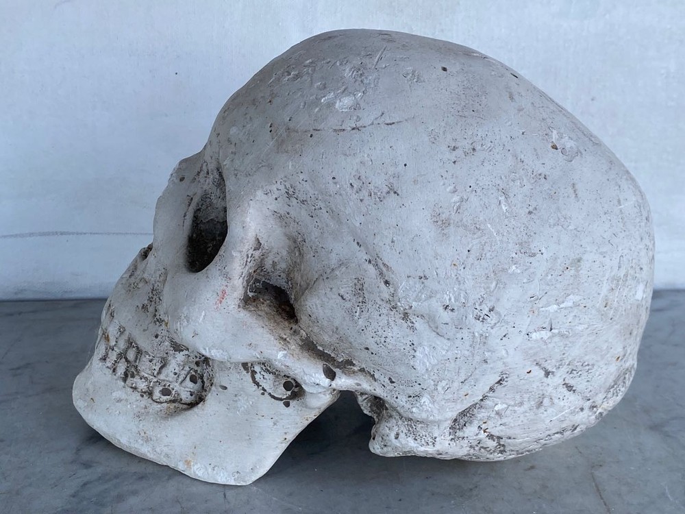 Vintage Solid Plaster Human Skull Head Model. Life Size. RARE
