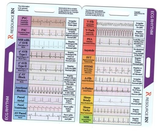 EKG Rhythm Interpretation - Compact & Portable Reference Card – Rapid