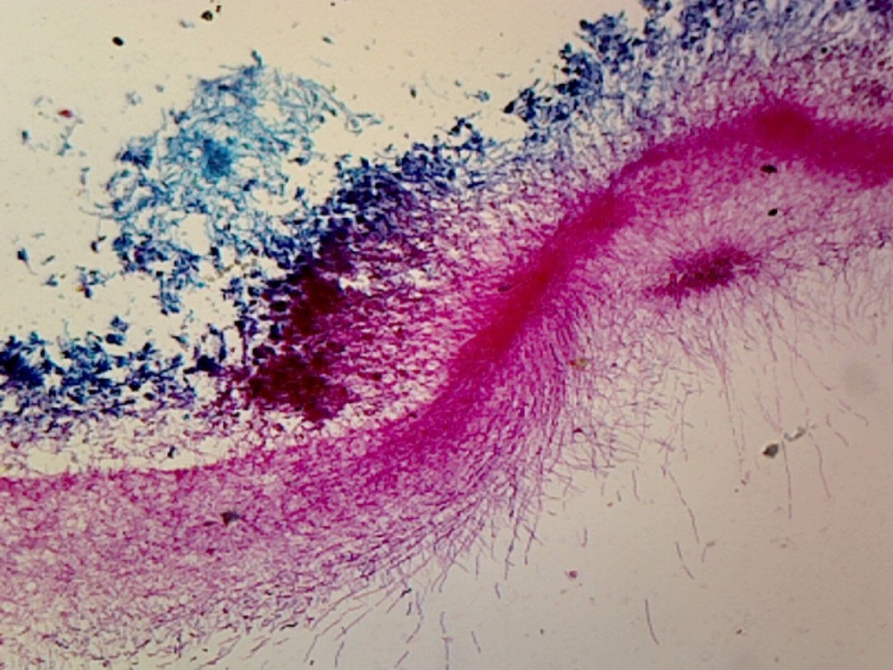 Penicillium; Whole-mount