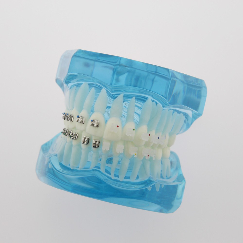 Dental Teach Study Typodont Teeth Model Half Metal Bracket Half Ceramic Bracket