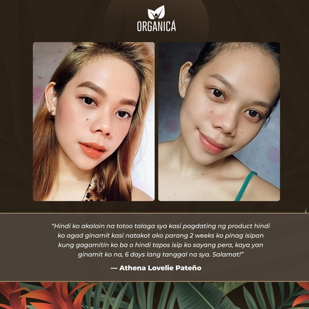 Multi-Awarded Mole and Warts Remover Set