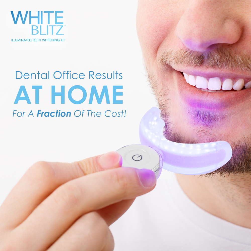 120 Application Complete White Blitz Illuminating Teeth Whitening Kit