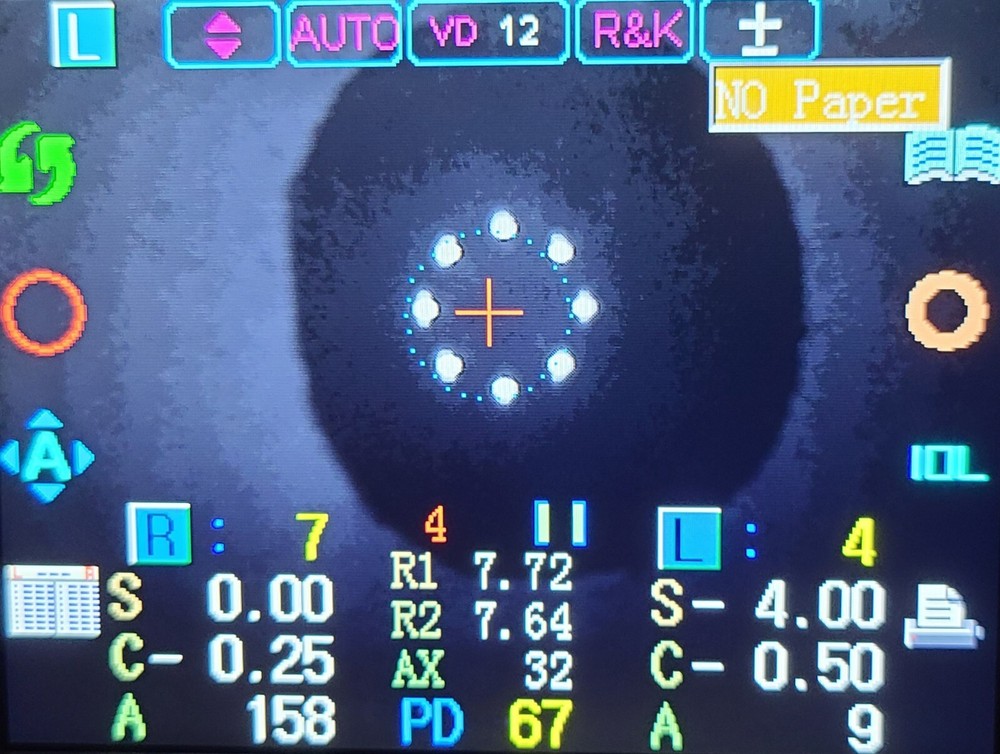 Autorefractor Keratometer ARK 9100