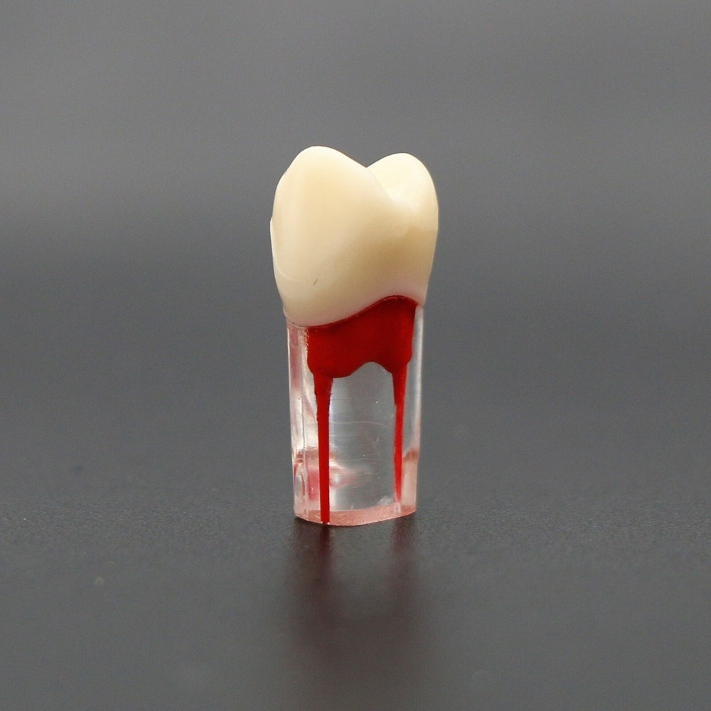 Dental Teeth Root Canal RCT Block Pulp Cavity Practice Model for Endo File Study