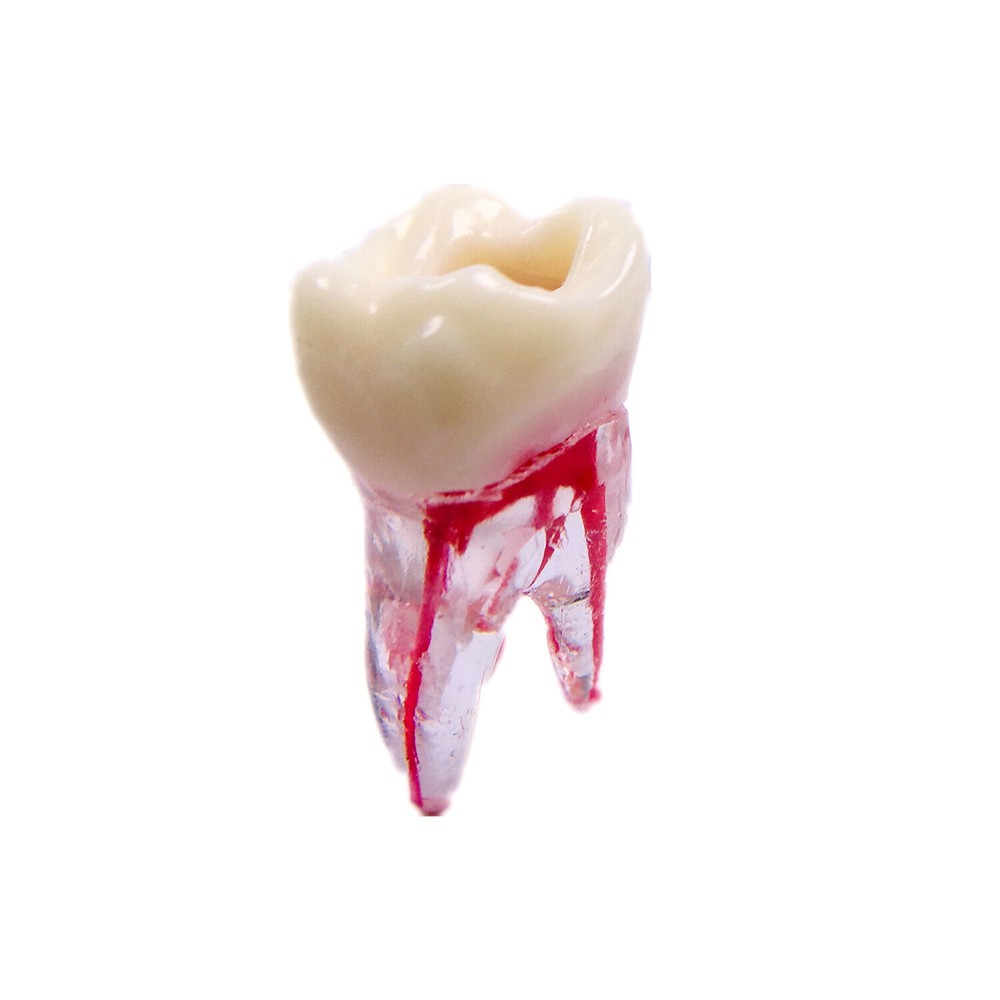 Dental Endo Root Canal File Training Study Model Student Practice Block Red Pulp