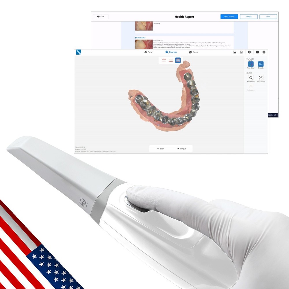 Dental Intraoral Scanner Digital Impression 3D Scanner with AI Scanning Function