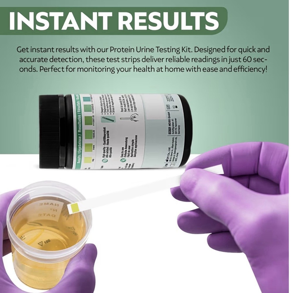 Urine Test Strips (One Step – 100 strips)