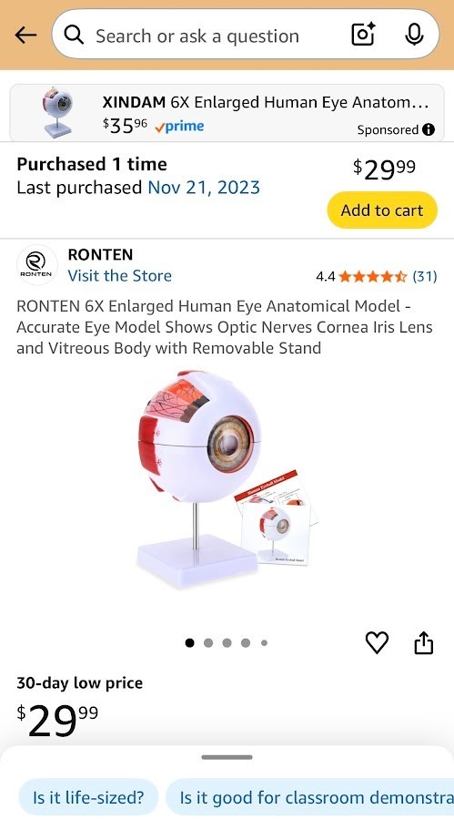 Ronten 6X Enlarged Human Eye Anatomical Model