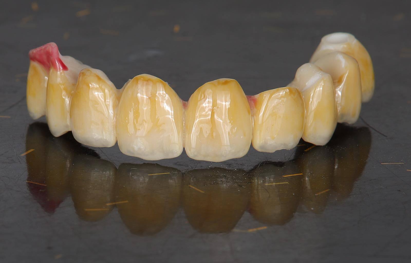 DLP SLA LCD 3d printer ALL ON X resin - for all on x cases, bridges,arcs, hybrid