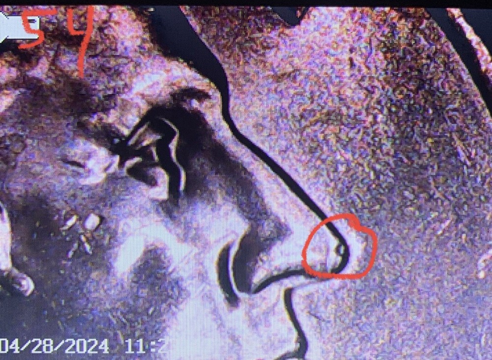 2023 P Edith Kanaka’Ole Quarter ERRORS Die Chip In God We Rust Uncirculated