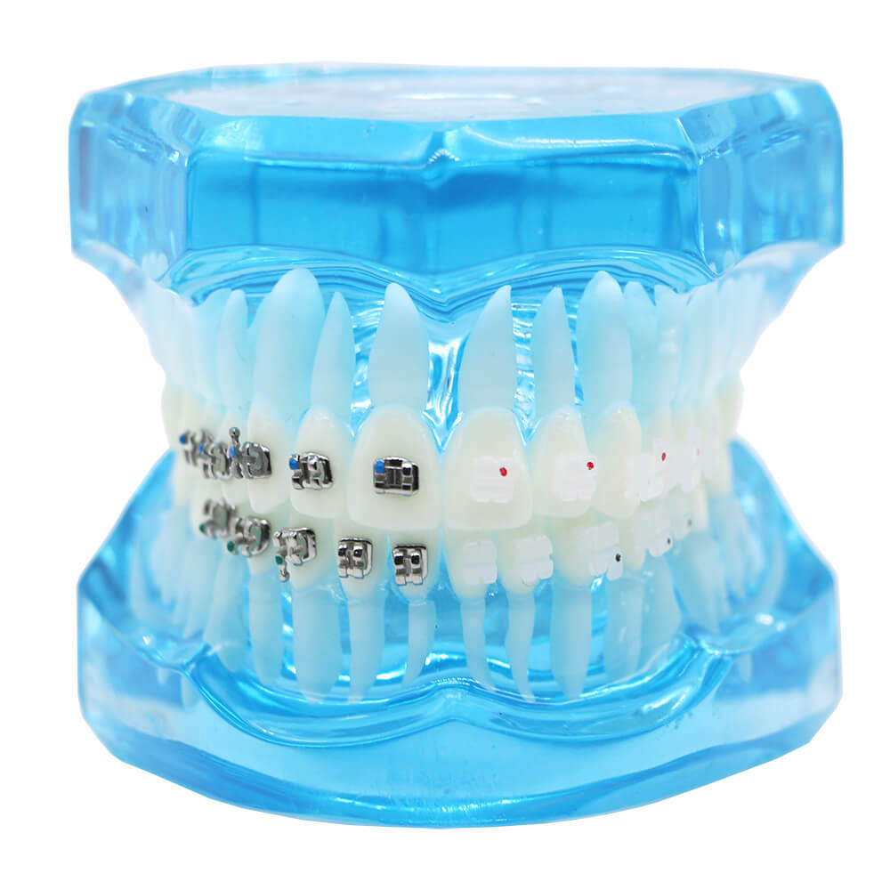 Dental orthodontic teach study teeth model mental and ceramic bracket contrust