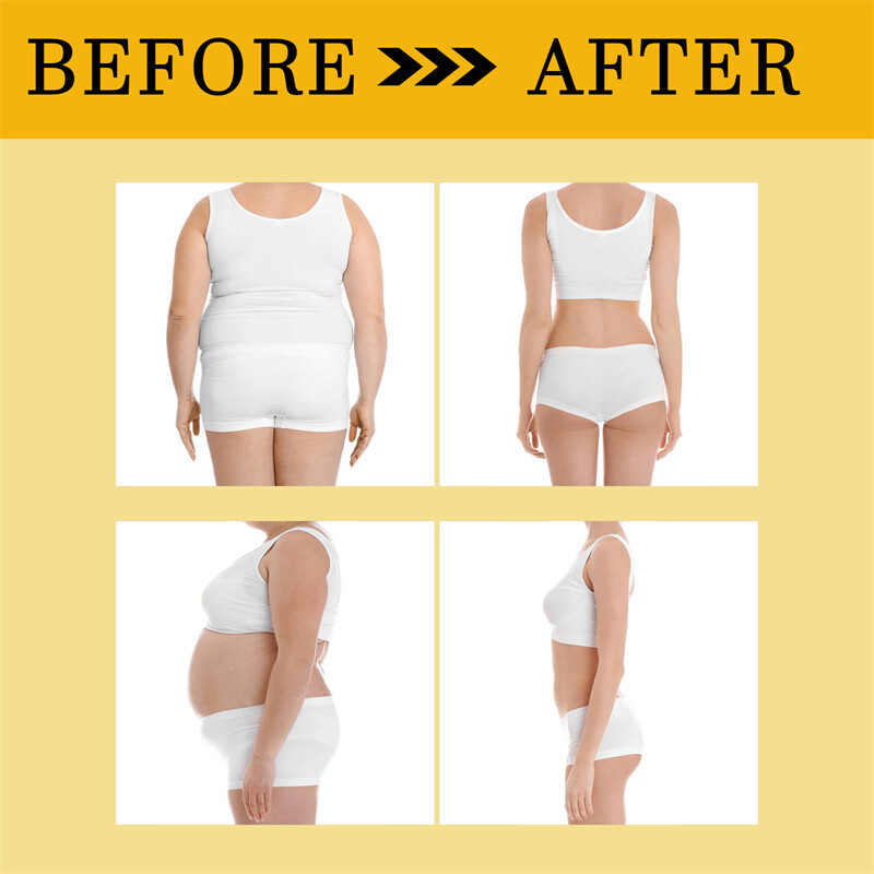 35PCS/5BOX Bee Venom Circulatory Drainage Slimming Patch NEW