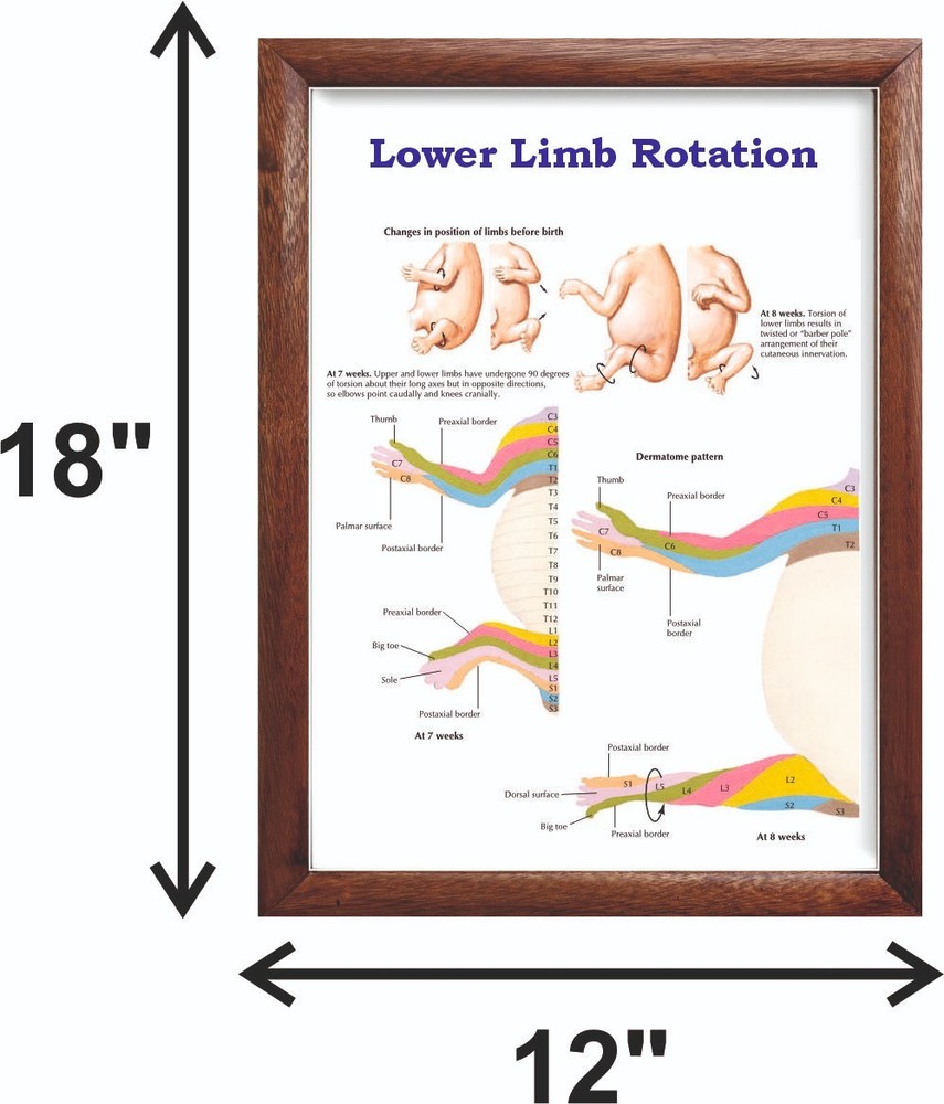 Lower Limb Rotation Chart 12x18 inches