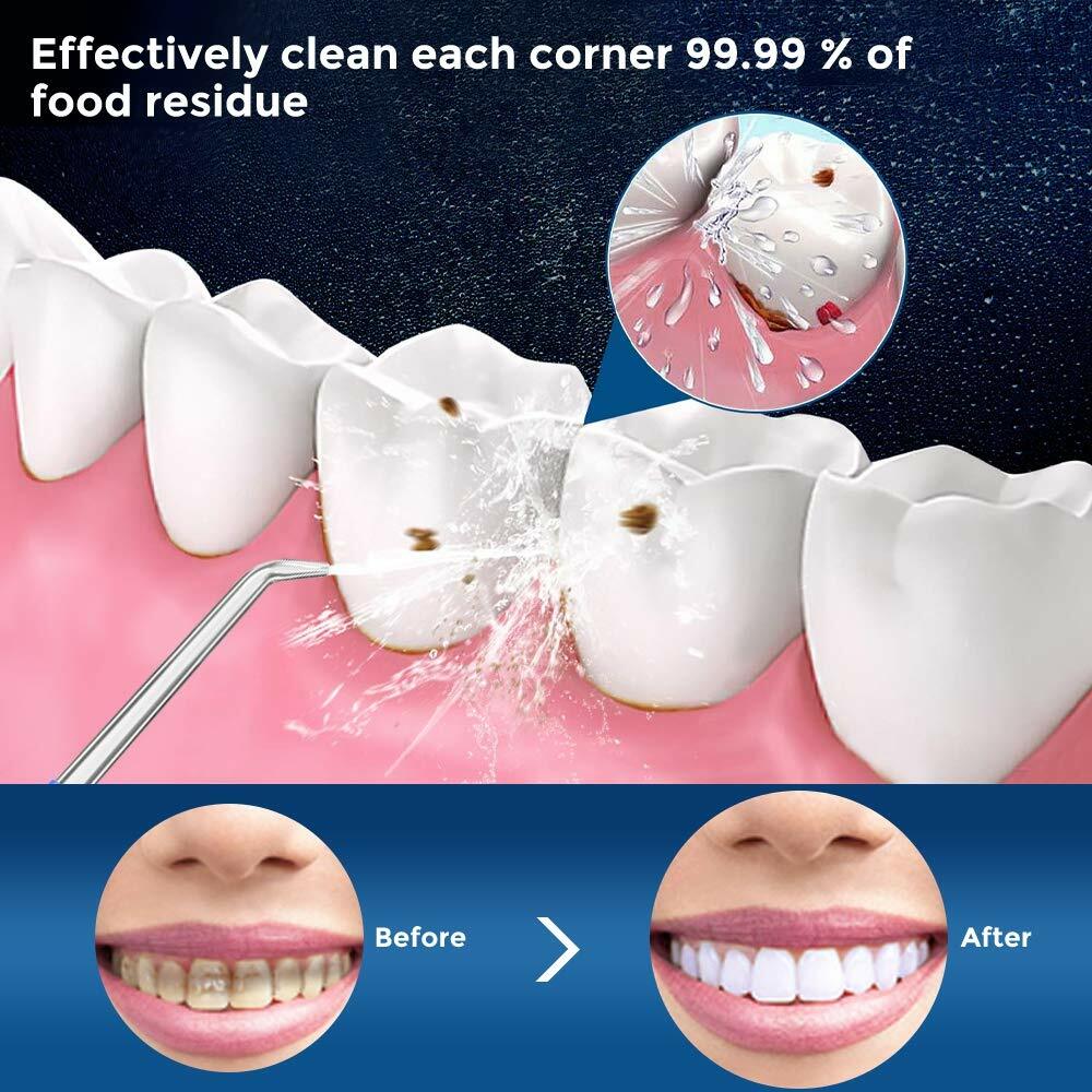Cordless Water Flosser Dental Oral Irrigator Travel Teeth Cleaner Floss Pick