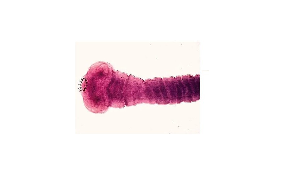 ABGIL Platyhelminthes Sildes.